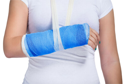 Woman with a broken arm.